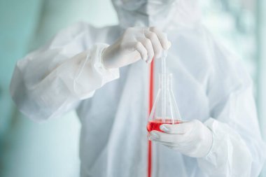 Medical scientist prepare liquid sample test in research lab for 2019-nCoV vaccine or serum.