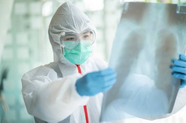 Koruyucu kıyafetli bir doktor, koğuş hastanesindeki hastanın göğüs röntgenini kontrol ediyor. Corona virüsü Covid-19 Kavramı.