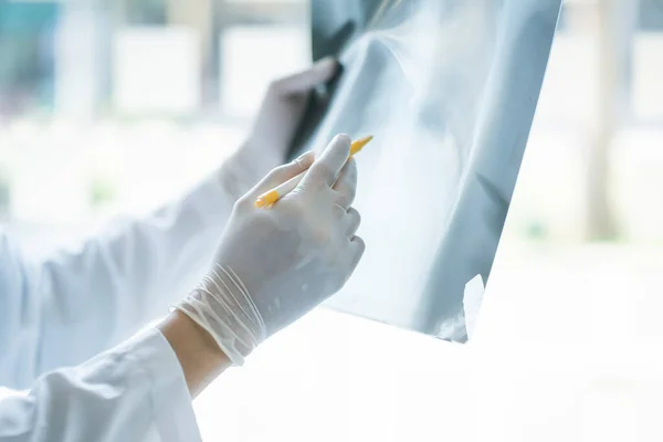 Medical Doctor checking examining chest x-ray film of patient at ward hospital. Corona virus Covid-19 Concept. Health care and medical services concept.