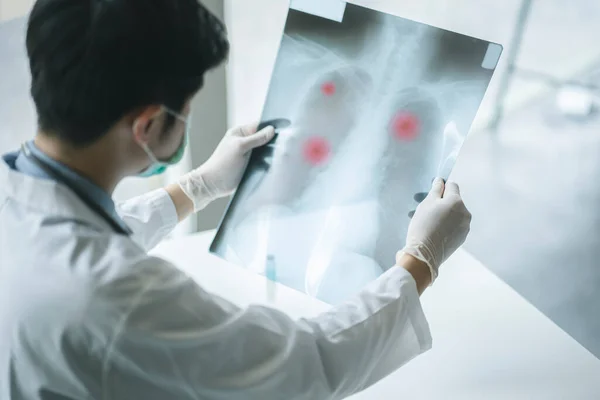 Medical Doctor checking examining chest x-ray film of patient at ward hospital. Corona virus Covid-19 Concept.