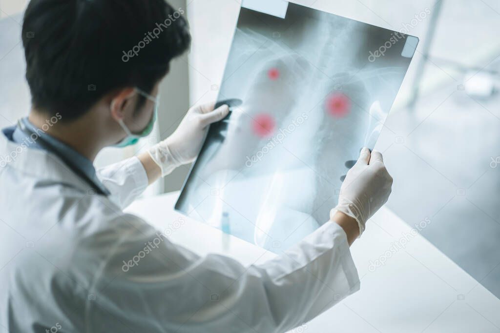 Medical Doctor checking examining chest x-ray film of patient at ward hospital. Corona virus Covid-19 Concept.