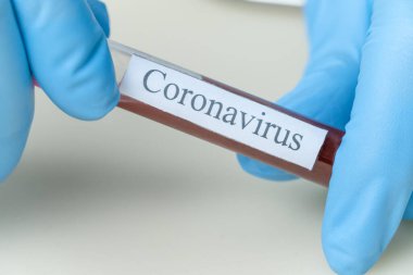Mavi eldivenli kadın eller önlerinde Coronavirus yazan bir tüp kan tutuyorlar. Tıp kavramı, analiz