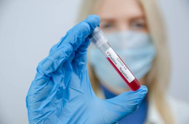 Tıbbi maskeli ve mavi eldivenli genç bayan hemşire Coronavirus için pozitif bir test sonucu tutuyor, bir tıp konsepti.