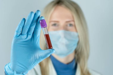 Sarışın genç doktor elinde mavi eldivenlerin içinde kan olan bir test tüpü tutuyor. Kan örnekleme, tıbbi ve kimyasal araştırma kavramı
