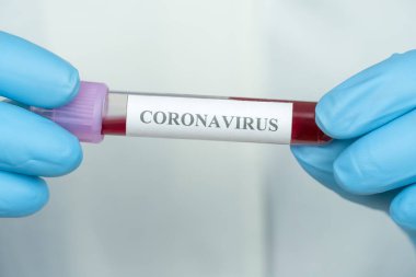 Mavi eldivenli kadın eller önlerinde Coronavirus yazan bir tüp kan tutuyorlar. Tıp kavramı, analiz