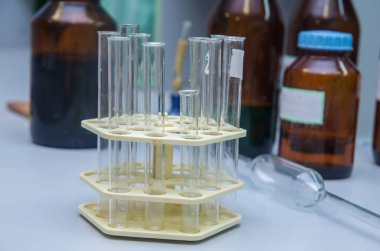 Laboratuvar test tüpleri kapanıyor.