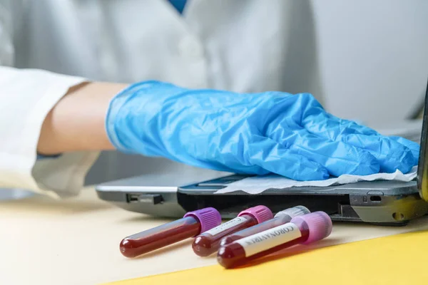 Woman\'s hand in blue medical gloves wipes the keyboard of a laptop with a disinfecting cloth, next to vials of blood. Concept of disinfection, coronavirus, tests