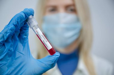 Tıbbi maskeli ve mavi eldivenli genç bayan hemşire Coronavirus için pozitif bir test sonucu tutuyor, bir tıp konsepti.