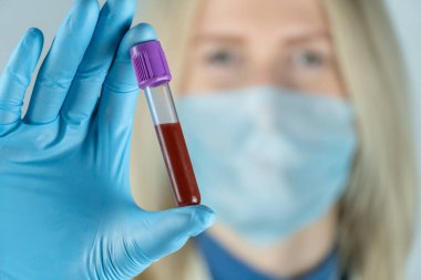 Sarışın genç doktor elinde mavi eldivenlerin içinde kan olan bir test tüpü tutuyor. Kan örnekleme, tıbbi ve kimyasal araştırma kavramı