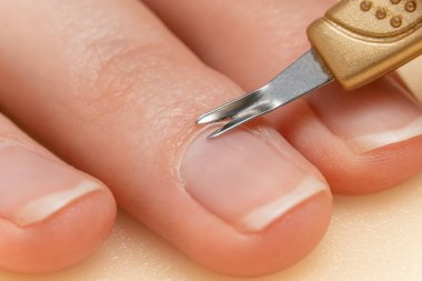 Kız kendi manikürünü yapıyor. Özel bir araçla parmağından tırnak içi aldırma işlemi
