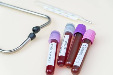 Masanın üzerinde Coronavirus, stetoskop, cıva termometre yazan kan şişeleri var. Arkaplan