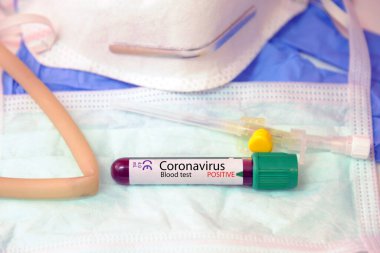 İtalya, Milan - Wuhan, Çin kökenli yeni hızla yayılan Coronavirüs için pozitif bir kan testi sonucu ve gırtlak örneği