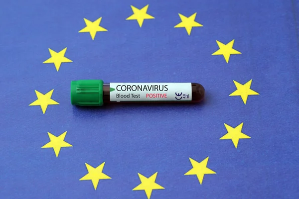 Resultado Positivo Análisis Sangre Para Nuevo Coronavirus Cov19 Rápida Propagación — Foto de Stock