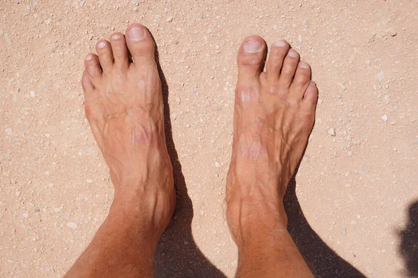 Fuß Und Beine Eines Mannes Sand Tropischen Badeort — Stockfoto
