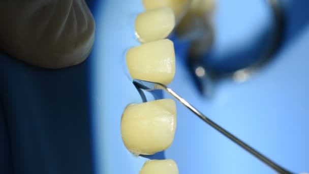 Dentista Che Cura Denti Paziente Con Strumenti Dentali Una Clinica — Video Stock