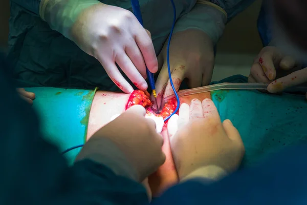 Team Surgeons Operating Hospital Close Hands Team Doctors Surgery — Stock Photo, Image