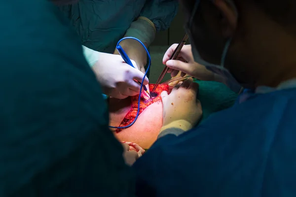 Equipo Cirujanos Operando Hospital Primer Plano Las Manos Equipo Médicos — Foto de Stock