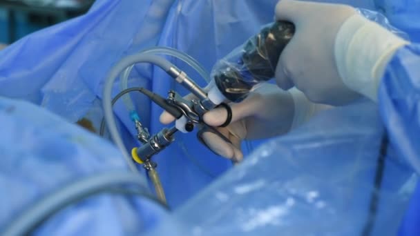 Uzavření Chirurgických Rukou Provádějících Laparoskopickou Operaci — Stock video