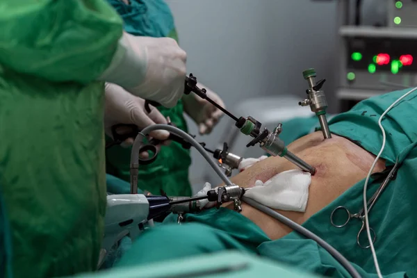 Surgeon Holding Instrument Abdomen Patient Surgeon Doing Laparoscopic Surgery Operating — Stock Photo, Image