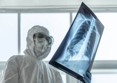 COVID-19, Coronavirus veya Novel Corona virüs salgını. PPE Kişisel Koruyucu Ekipmanı 'nda çalışan doktor veya laboratuvar teknisyeni, akciğer göğüs röntgeni görüntüsünü hastane laboratuvarında tutuyor.