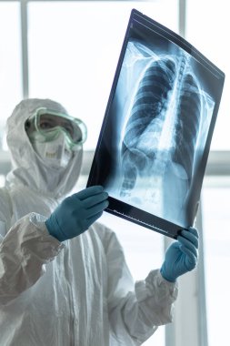 COVID-19, Coronavirus veya Novel Corona virüs salgını. PPE Kişisel Koruyucu Ekipmanı 'nda çalışan doktor veya laboratuvar teknisyeni, akciğer göğüs röntgeni görüntüsünü hastane laboratuvarında tutuyor.