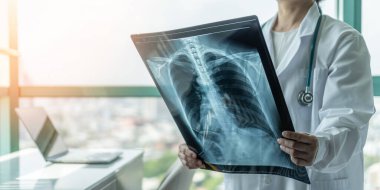 Doktor, astım, akciğer hastalığı, COVID-19 veya radyolojik göğüs röntgeni olan kemik kanseri hastalığını teşhis etti.