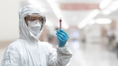 COVID-19, Corona Virüsü veya Roman Coronavirüs salgını. PPE 'de çalışan doktor veya laboratuvar teknisyeni, hastane laboratuvarında kan tüpü testi yapıyor.