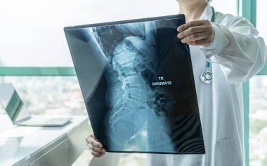 Surgical doctor looking at radiological spinal X-ray film for medical diagnosis on patients health on spine disease, bone cancer illness, spinal muscular atrophy, medical healthcare concept clipart