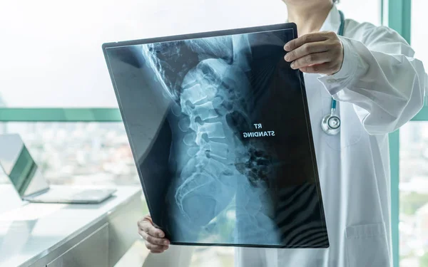 Kirurgisk Läkare Tittar Radiologisk Ryggradsröntgenfilm För Medicinsk Diagnos Patienter Hälsa — Stockfoto