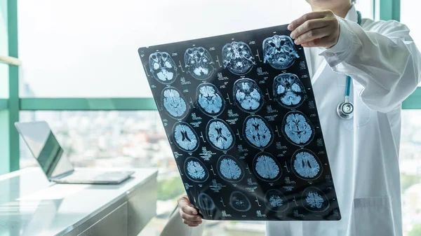 Yaşlanan hastaların nörolojik tedavi için nörodejeneratif hastalık sorunu teşhisi koyan Manyetik Rezonans Görüntüleme (MRI) filmini izleyen tıp doktorunun beyin hastalıkları teşhisi