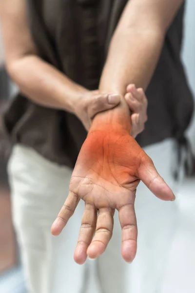 Periferní Neuropatie Bolest Starších Pacientů Ruce Dlaň Prsty Smyslové Nervy — Stock fotografie