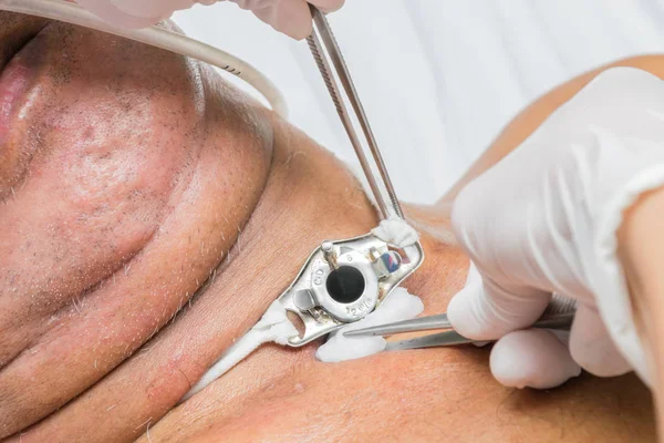 Nefes al ve onların yataklarda uyumak için boğazlarını delip hastalarda Serebral Palsili, Doktor onları nerede boynunda yara temizlemek için bekçi vardı onların ev için her sabah ve akşam alkol dezenfeksiyon ile geri dönmek izin