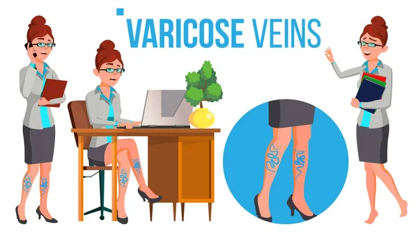 Gambe femminili in scarpe tacco alto con vene varicose vettoriale. Illustrazione isolata del fumetto — Vettoriale Stock