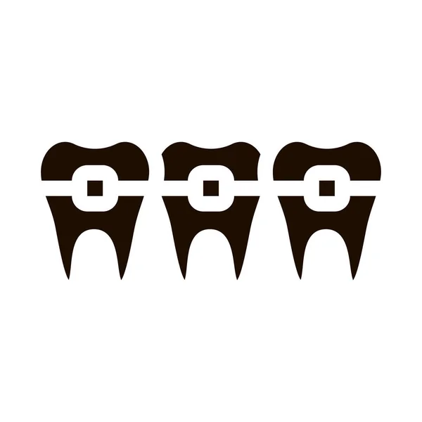 Знак Вектора Зубных Брекетов Стоматолога Кронштейн Зубов Ортодонтическая Пиктограмма Монохромная — стоковый вектор