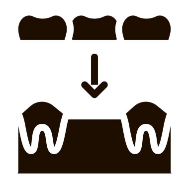 Diş Protezi Stomatoloji Vektör İmza Simgesi. Stomatoloji Dişçi Ekipman ve Aygıt Piktogramı. Tıbbi Tedavi Terapisi Diş Hekimliği Tek Renkli Çizim