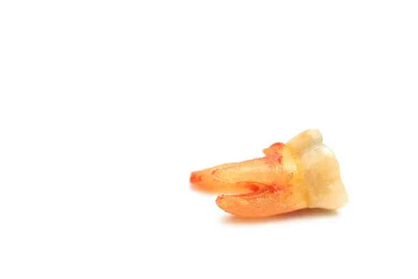 Extrahierte Karies Zahn Isoliert Auf Weißem Hintergrund Nahaufnahme Makro Dental — Stockfoto