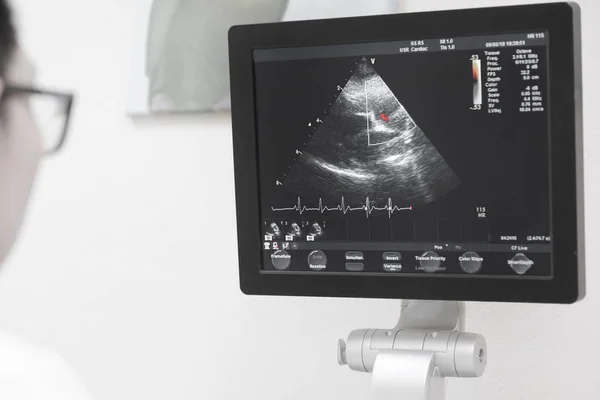 Close Image Computer Screen Ultrasound Scanning Machine Hospital Take Selective — Stock Photo, Image