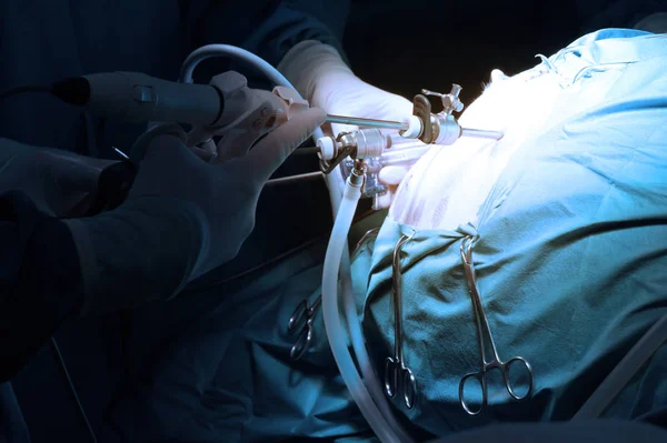 獣医の医者の芸術と腹腔鏡手術を手術室で照明とブルー フィルター — ストック写真