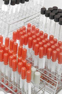 Hastanedeki laboratuvarda kan testi.