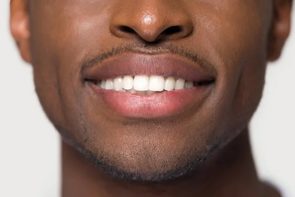 特写 非洲 男性 有 超 白色 牙齿 微笑 — 图库照片