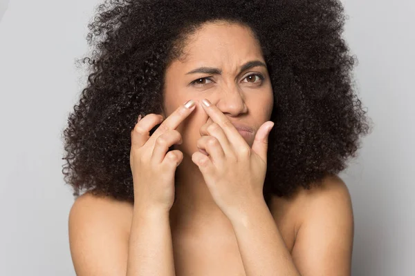African American girl unhappy with skin squeezing pimples — Stock Photo, Image