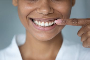 Sağlıklı bir gülümsemeyi işaret eden Afrikalı Amerikalı kadını kapatın.
