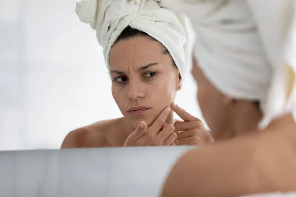 Cerca de mujer infeliz exprimir grano en la mejilla después de la ducha —  Fotos de Stock