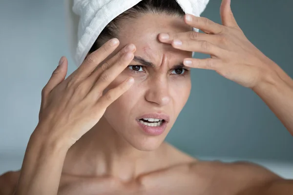 Close up angry unhappy woman squeezing pimple on forehead — Stock Photo, Image