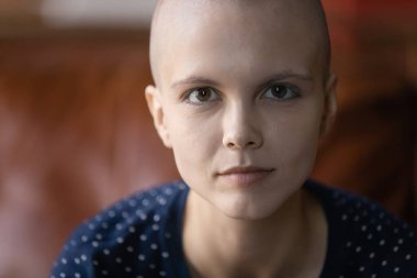 Kanserden muzdarip genç bir kadının yakın portresi