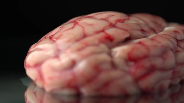 Cerebro Con Zonas Daño Concepto Infección Apoyo Para Ciencia Horror — Vídeo de stock