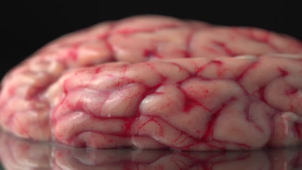 Cerveau Avec Zones Endommagées Concept Infection Accessoire Pour Science Horreur — Video