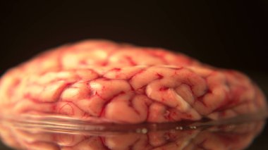 Beyin hasar bölgeleri ve enfeksiyon kavramı prop bilim veya korku Halloween için. Doktor gösteri için, cerrahi öğrenciler için tıp kliniğinde gerçek zamanlı anatomi çalışması. 