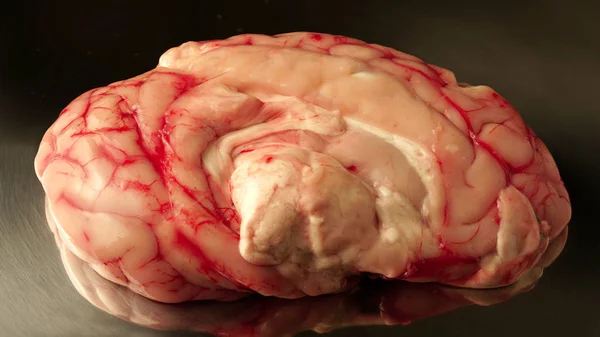 Cerebro con zonas de daño y concepto de infección de apoyo para la ciencia o el horror de Halloween. Para demostración médica, estudio de anatomía en tiempo real en clínica médica para estudiantes de cirugía . — Foto de Stock