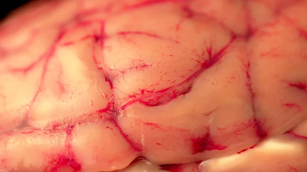 Мозг с зонами повреждения и концепцией заражения для науки или ужасов Хэллоуина. Исследование анатомии в режиме реального времени для студентов хирургической клиники . — стоковое фото